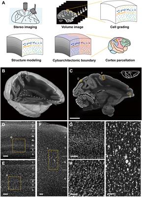 A complementary approach for neocortical cytoarchitecture inspection with cellular resolution imaging at whole brain scale